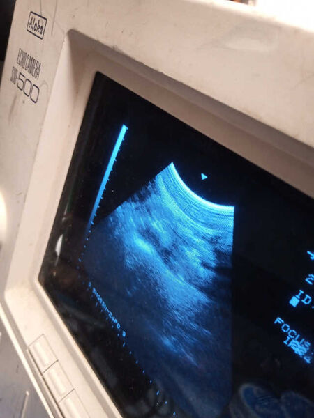 26 Aloka SSD 500 Ultrasound Scanner